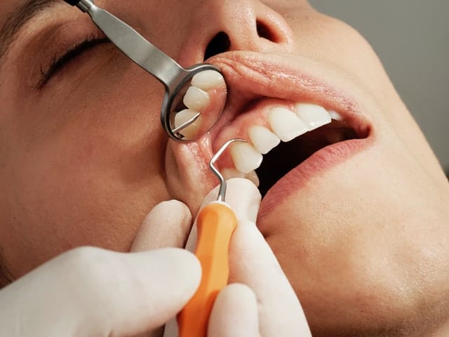 1. Clareamento dental 
