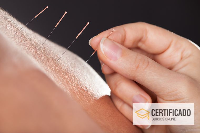 Quem Pode Fazer Curso de Acupuntura: Descubra os Pré-Requisitos e ...