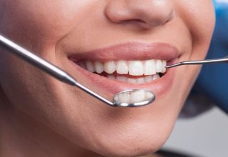 Curso de Estética Periodontal