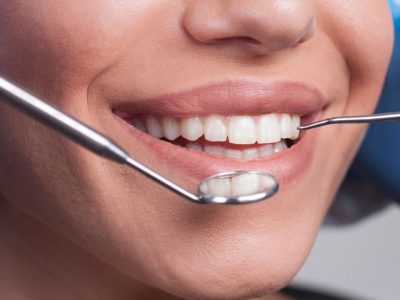 Curso de Estética Periodontal