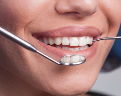 Curso de Estética Periodontal